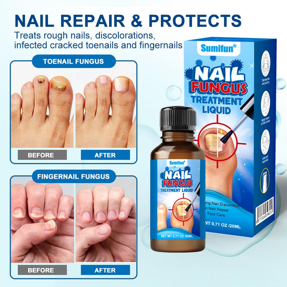 Herbal Anti-Fungal Tree Tea Oil Nail Liquid