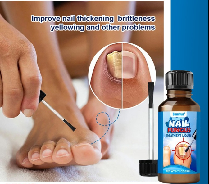 Herbal Anti-Fungal Tree Tea Oil Nail Liquid